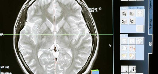 For How Long Human Brain Live After Death -- A Quick Explanation Here