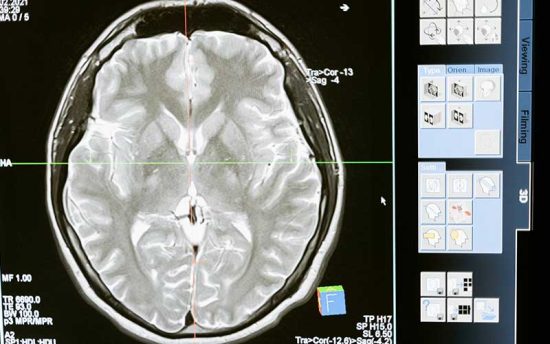 For How Long Human Brain Live After Death -- A Quick Explanation Here